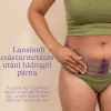 Lansinoh Császármetszés utáni hidrogél párna #69810