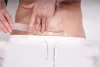 Momcare Császármetszés hegkezelő szilikontapasz #L-XL